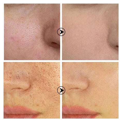 Pore Refining – Retinol & Niacinamide Brightening Serum