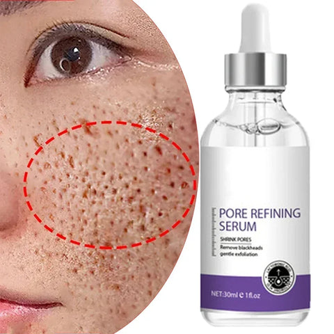 Pore Refining – Retinol & Niacinamide Brightening Serum