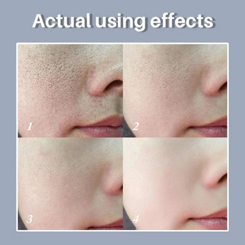 Pore Refining – Retinol & Niacinamide Brightening Serum